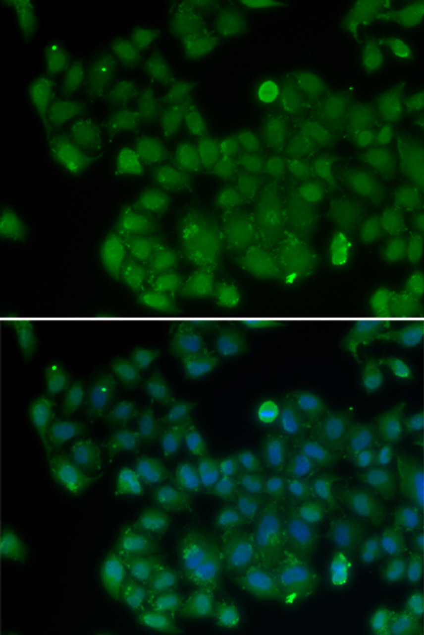 Immunofluorescence analysis of U2OS cells using DNMT3L Polyclonal Antibody