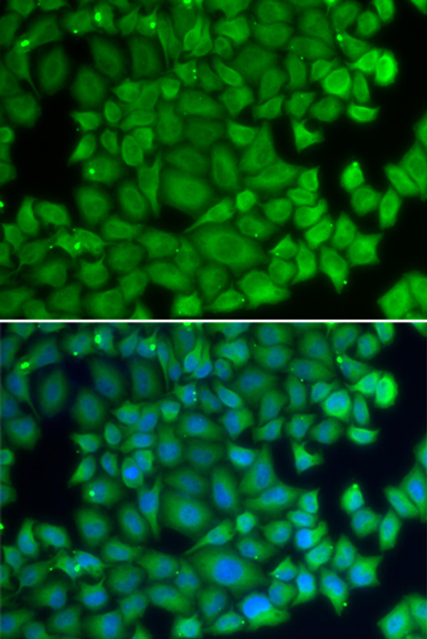 Immunofluorescence analysis of U2OS cells using HSPB2 Polyclonal Antibody
