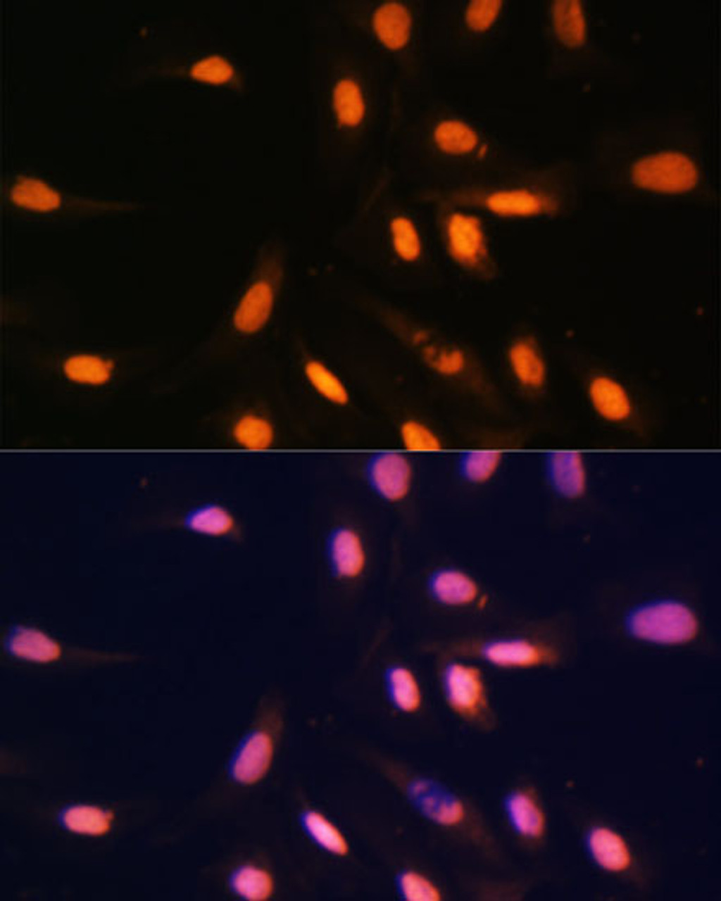 Immunofluorescence analysis of U-2 OS cells using MonoMethyl-Histone H3-K4 Polyclonal Antibody at dilution of  1:100. Blue: DAPI for nuclear staining.