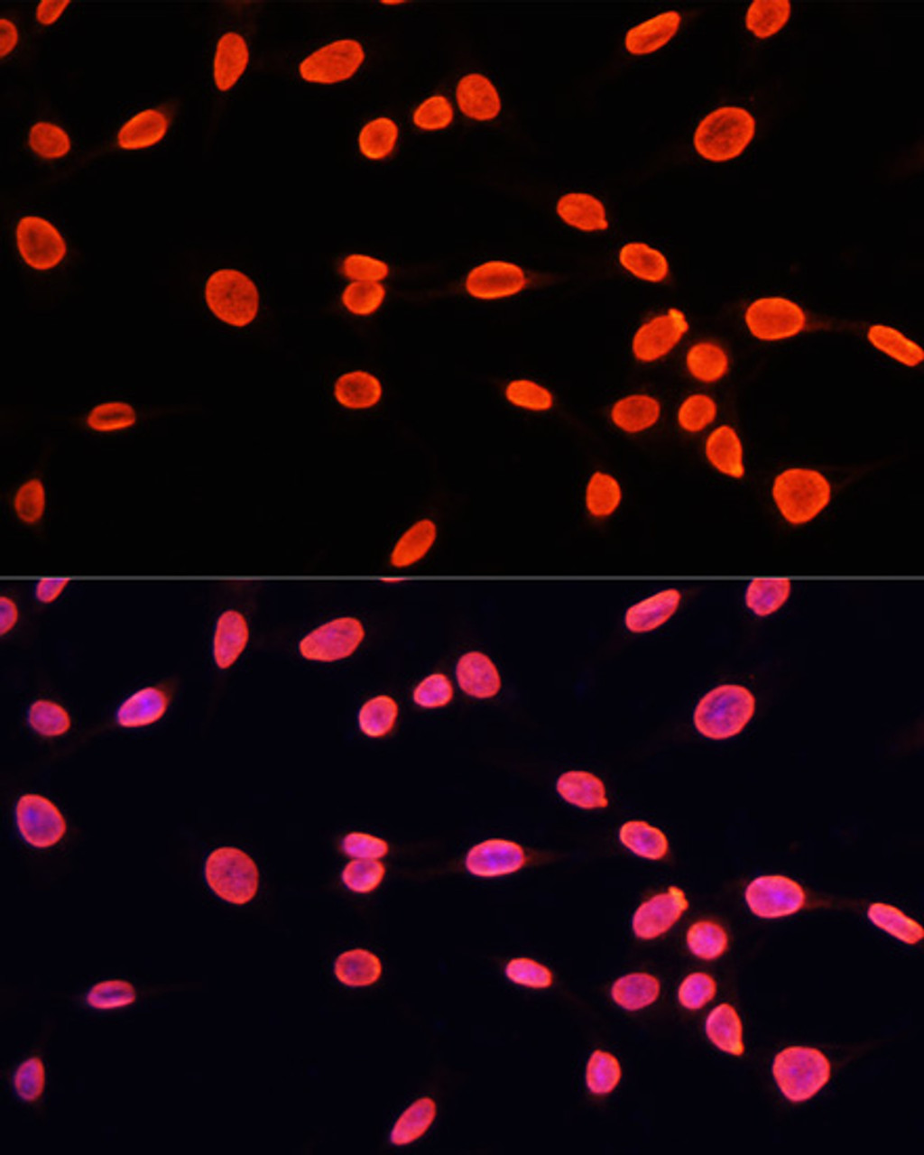 Immunofluorescence analysis of C6 cells using MonoMethyl-Histone H3-K9 Polyclonal Antibody at dilution of  1:100. Blue: DAPI for nuclear staining.