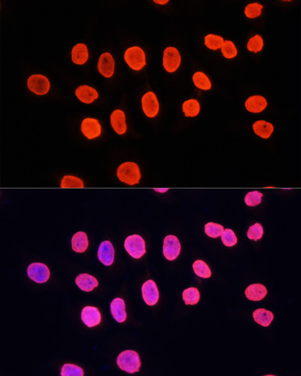 Immunofluorescence analysis of HeLa cells using MonoMethyl-Histone H3-K9 Polyclonal Antibody at dilution of  1:100. Blue: DAPI for nuclear staining.