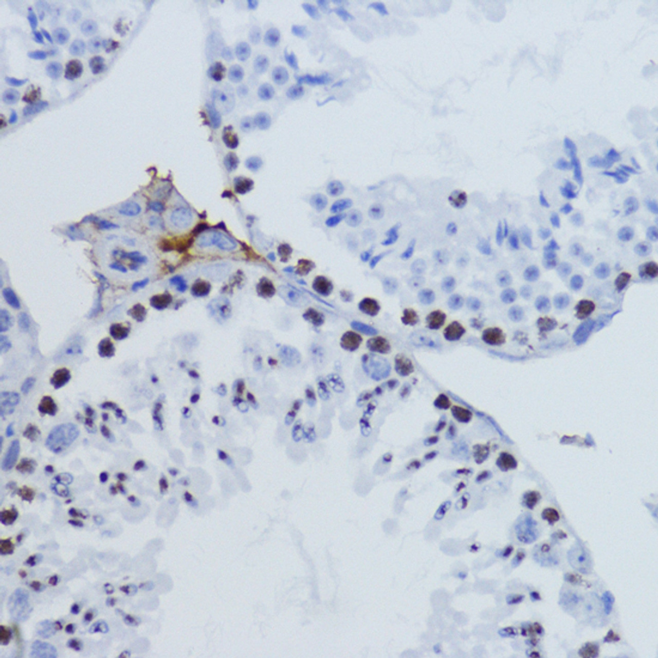 Immunohistochemistry of paraffin-embedded Mouse testis using TriMethyl-Histone H3-K9 Polyclonal Antibody at dilution of  1:200 (40x lens).