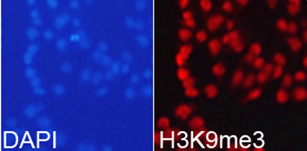 Immunofluorescence analysis of 293T cells using TriMethyl-Histone H3-K9 Polyclonal Antibody