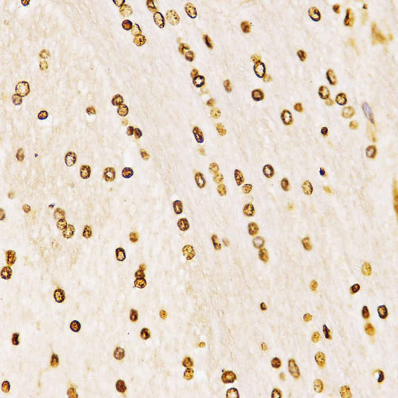 Immunohistochemistry of paraffin-embedded Rat brain using MonoMethyl-Histone H3-K27 Polyclonal Antibody at dilution of  1:200 (40x lens).