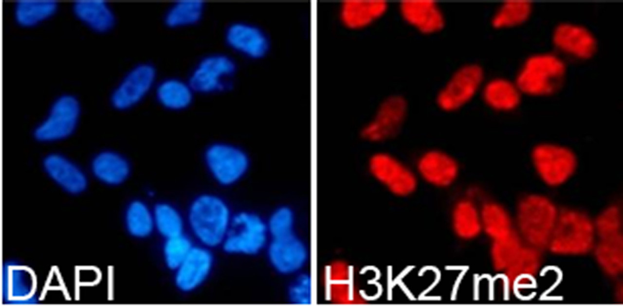 Immunofluorescence analysis of 293T cells using DiMethyl-Histone H3-K27 Polyclonal Antibody