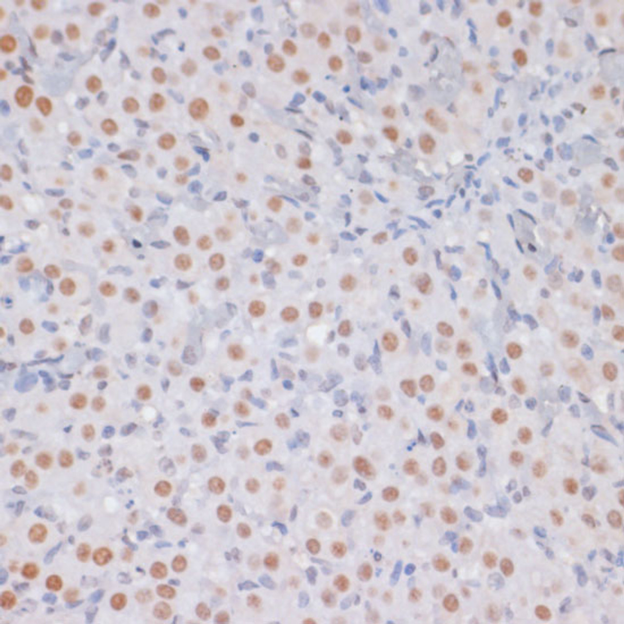 Immunohistochemistry of paraffin-embedded Rat ovary using TriMethyl-Histone H3-K27 Polyclonal Antibody at dilution of  1:100 (40x lens).