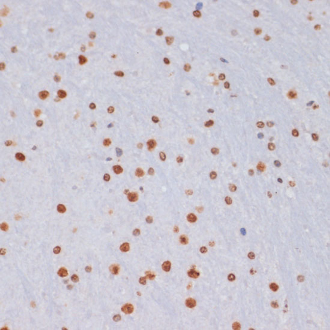 Immunohistochemistry of paraffin-embedded Mouse brain using TriMethyl-Histone H3-K27 Polyclonal Antibody at dilution of  1:100 (40x lens).