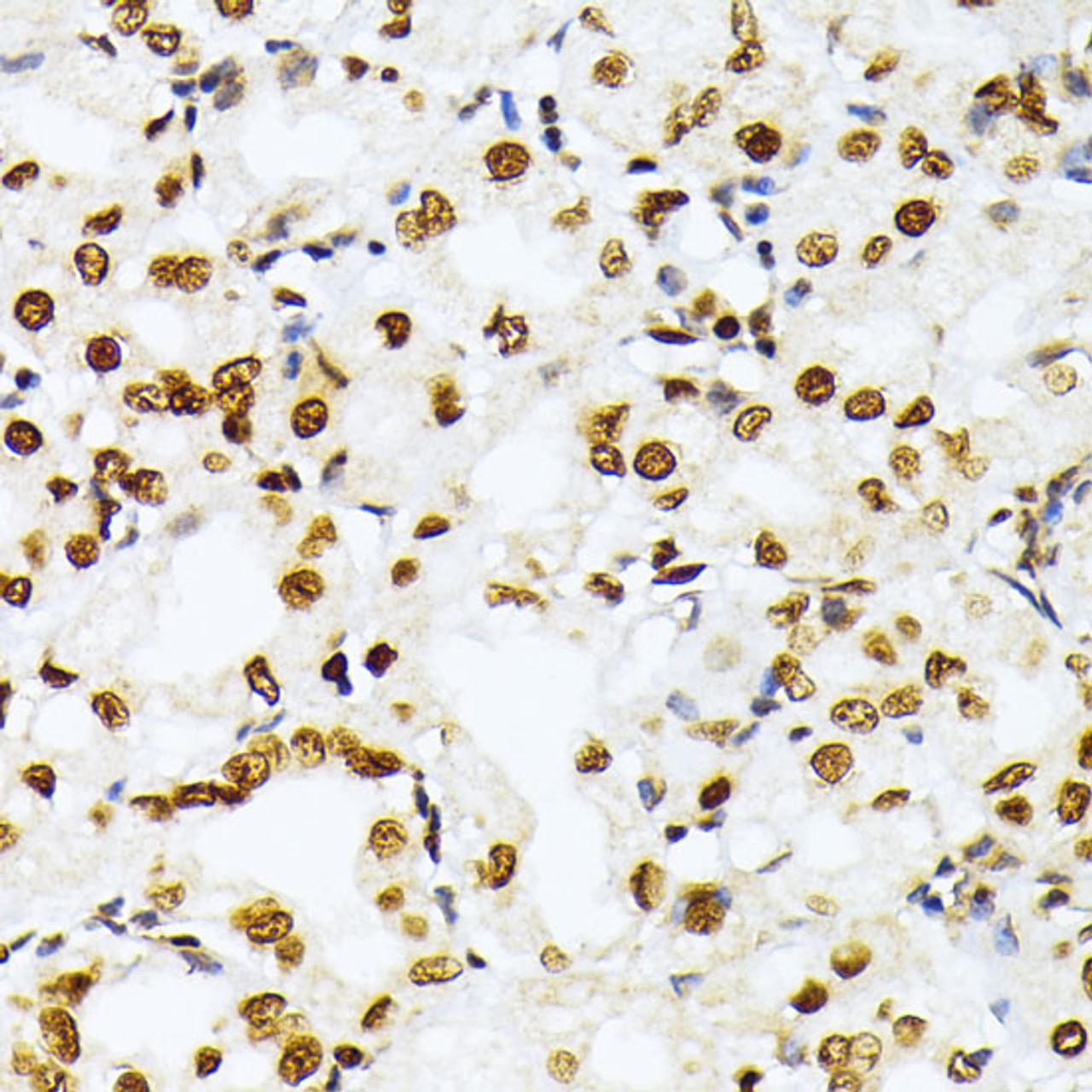 Immunohistochemistry of paraffin-embedded Human stomach using TriMethyl-Histone H3-K27 Polyclonal Antibody at dilution of  1:100 (40x lens).