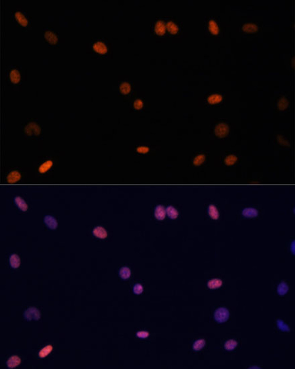 Immunofluorescence analysis of C6 cells using TriMethyl-Histone H3-K27 Polyclonal Antibody at dilution of  1:100. Blue: DAPI for nuclear staining.