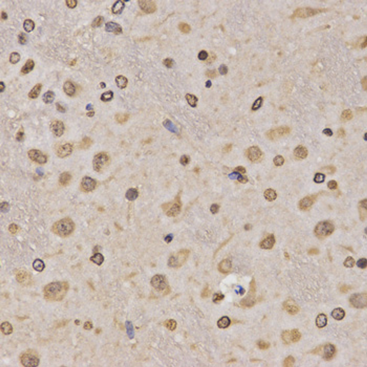 Immunohistochemistry of paraffin-embedded Rat brain using MonoMethyl-Histone H3-K36 Polyclonal Antibody at dilution of  1:200 (40x lens).