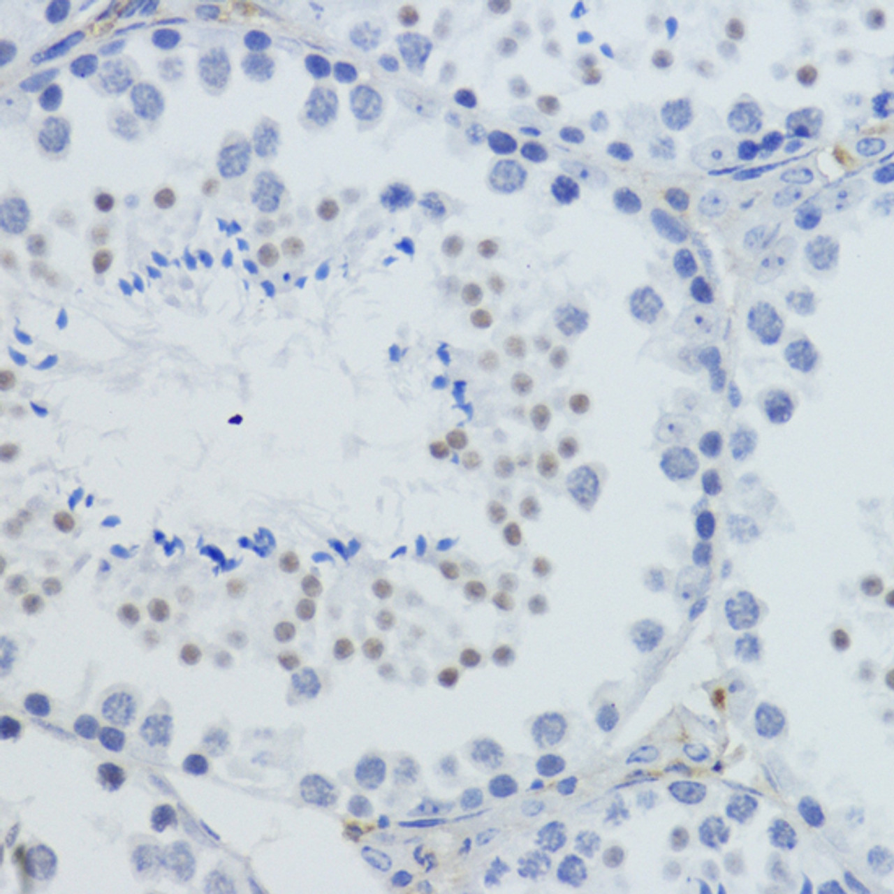 Immunohistochemistry of paraffin-embedded Mouse testis using TriMethyl-Histone H4-K20 Polyclonal Antibody at dilution of  1:200 (40x lens).