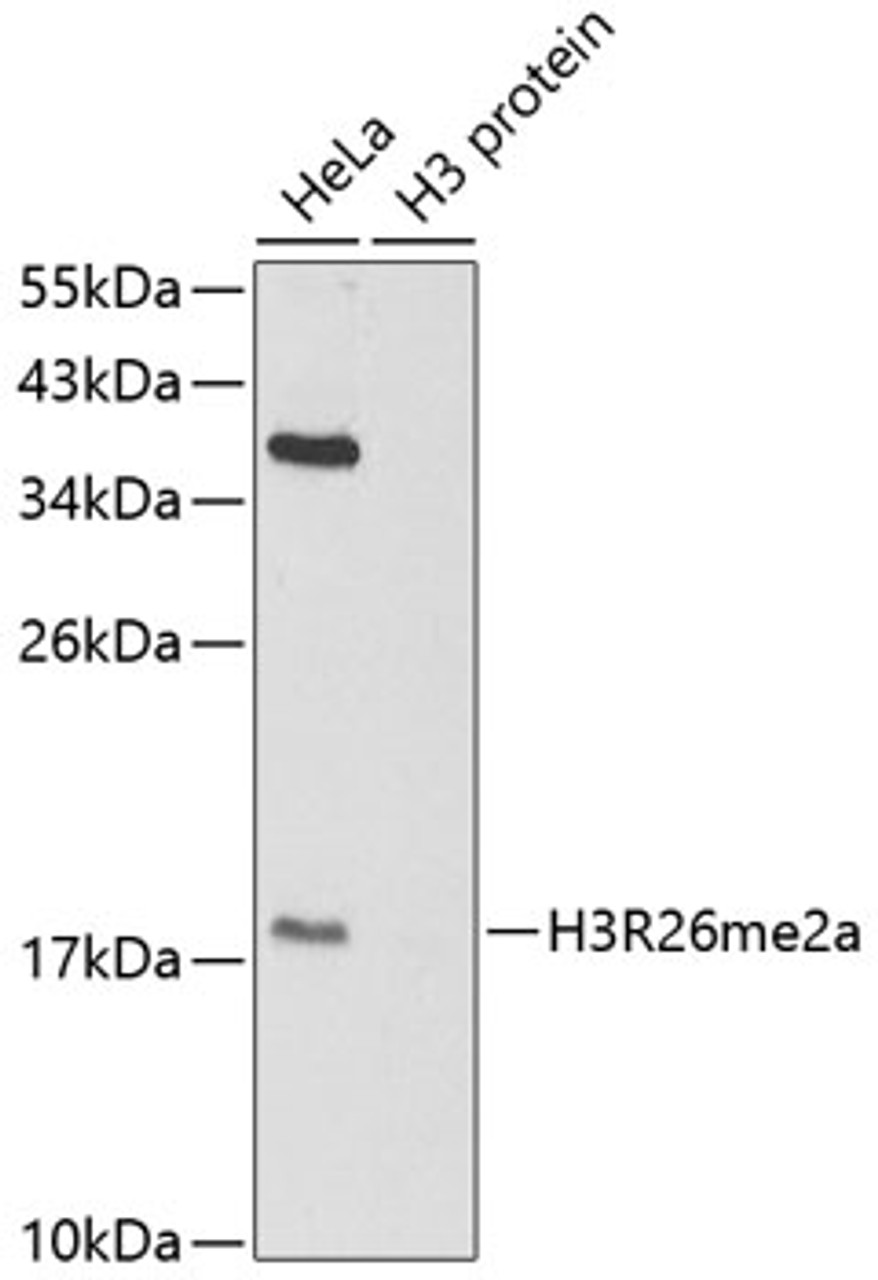 Western blot analysis of extracts of various cell lines using Asymmetric DiMethyl-Histone H3-R26 Polyclonal Antibody.
