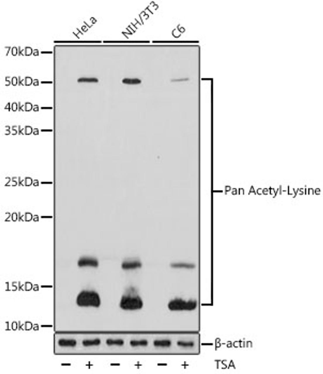 Western blot analysis of extracts of various cell lines using Pan Acetyl-Lysine Polyclonal Antibody at dilution of 1:1000. HeLa cells and NIH/3T3 cells and C6 cells were treated by TSA (1 uM) at 37°C for 18 hours.