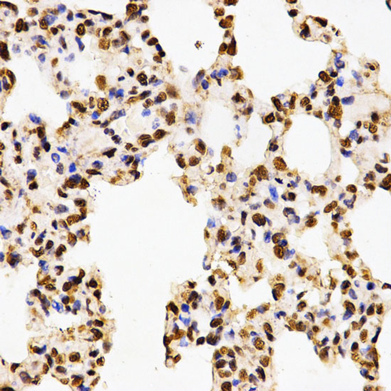 Immunohistochemistry of paraffin-embedded Rat lung using Asymmetric DiMethyl-Histone H3-R17 Polyclonal Antibody at dilution of  1:200 (40x lens).