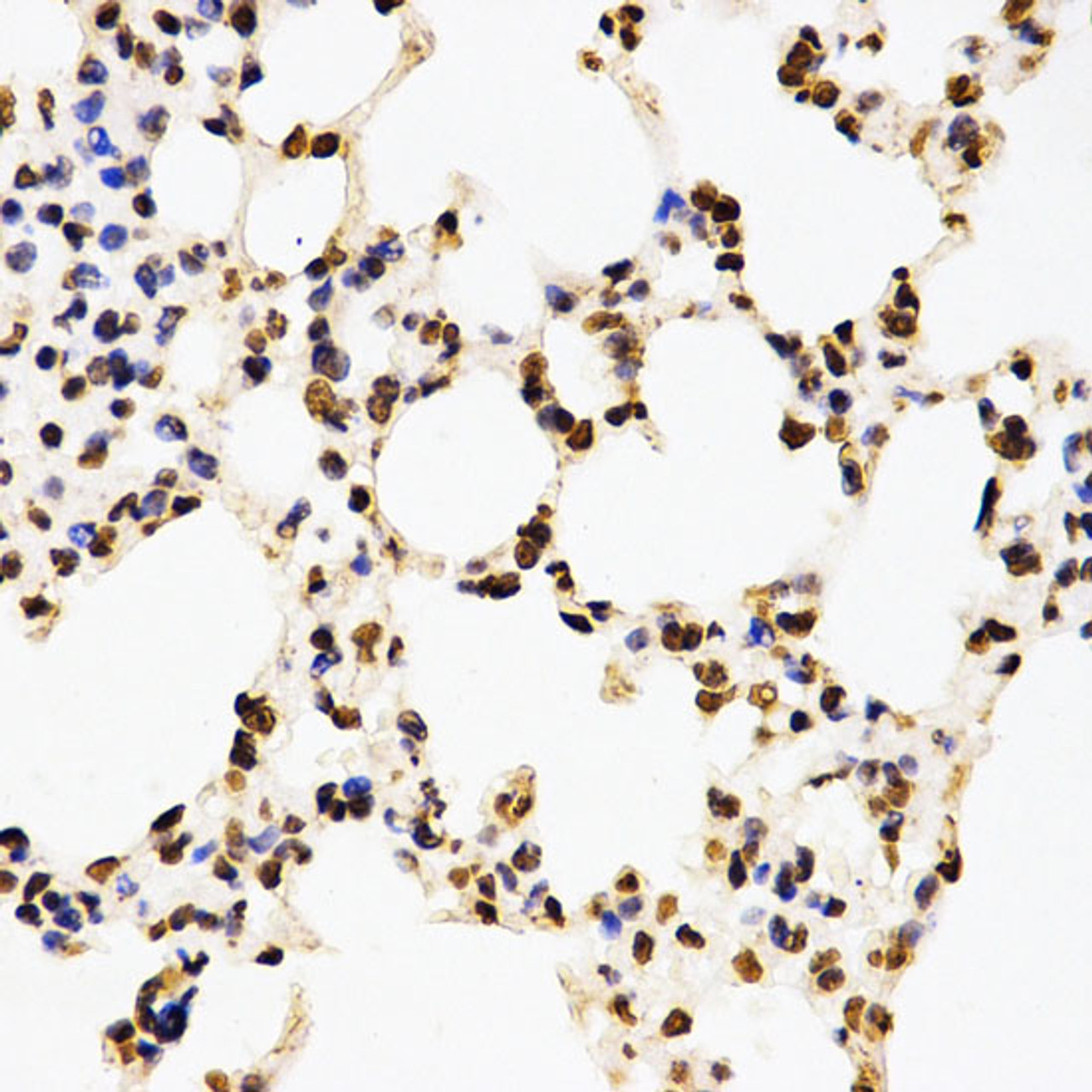 Immunohistochemistry of paraffin-embedded Mouse lung using Asymmetric DiMethyl-Histone H3-R17 Polyclonal Antibody at dilution of  1:200 (40x lens).