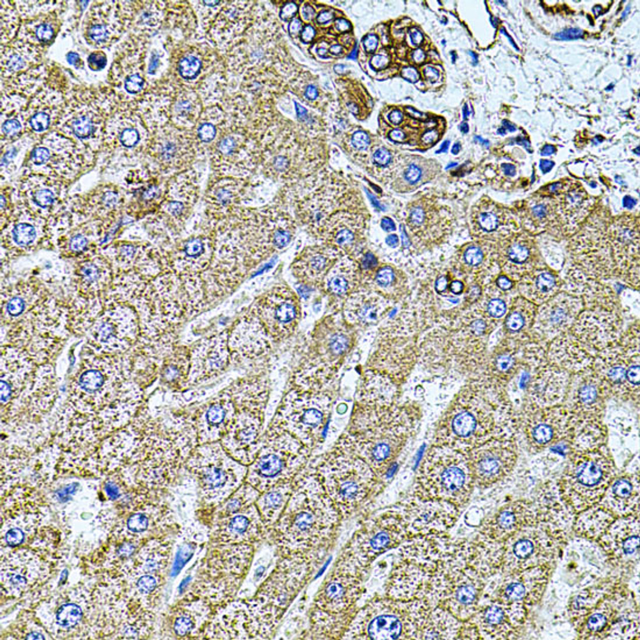 Immunohistochemistry of paraffin-embedded Human liver damage using FLNB Polyclonal Antibody at dilution of  1:100 (40x lens).