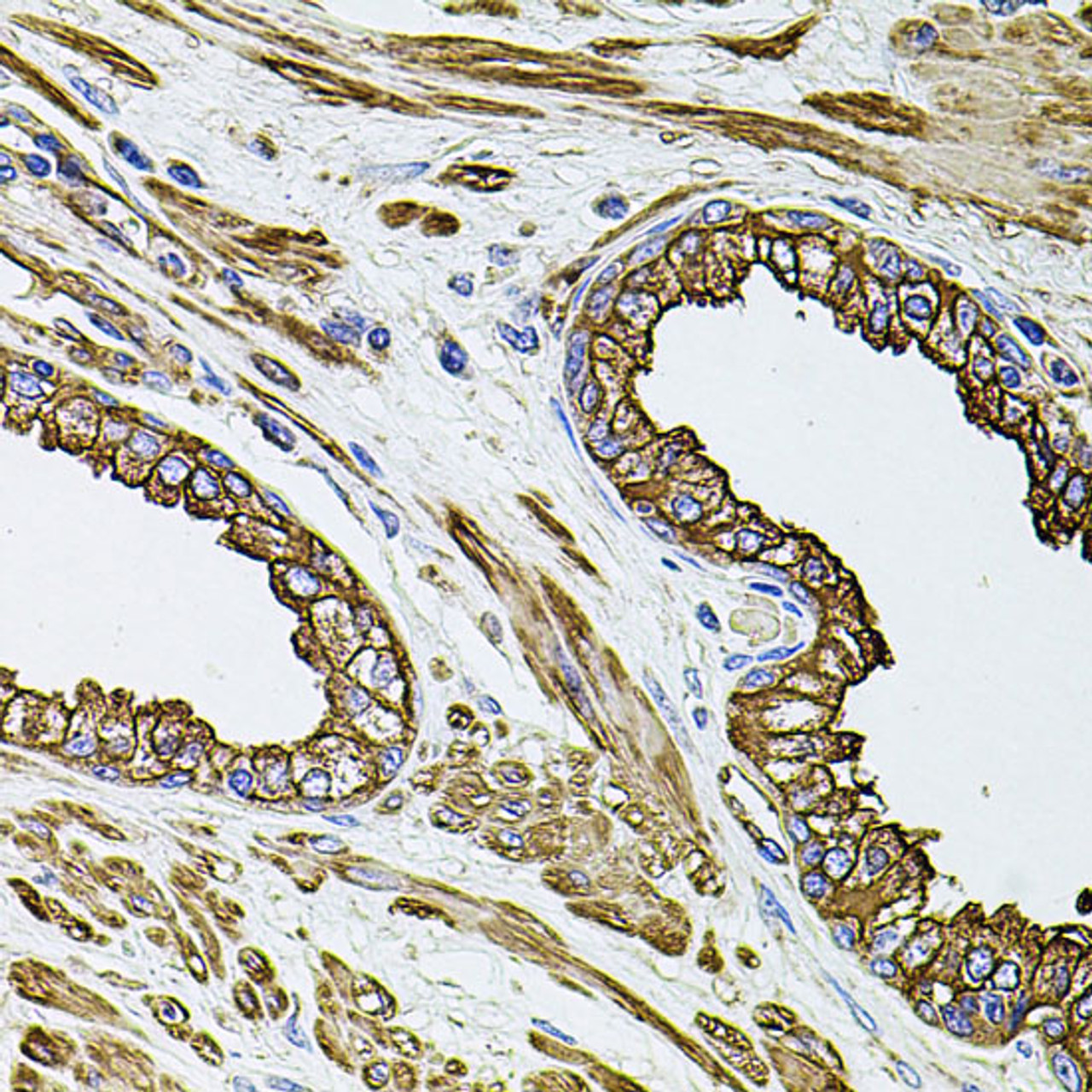 Immunohistochemistry of paraffin-embedded Human prostate using FLNB Polyclonal Antibody at dilution of  1:100 (40x lens).