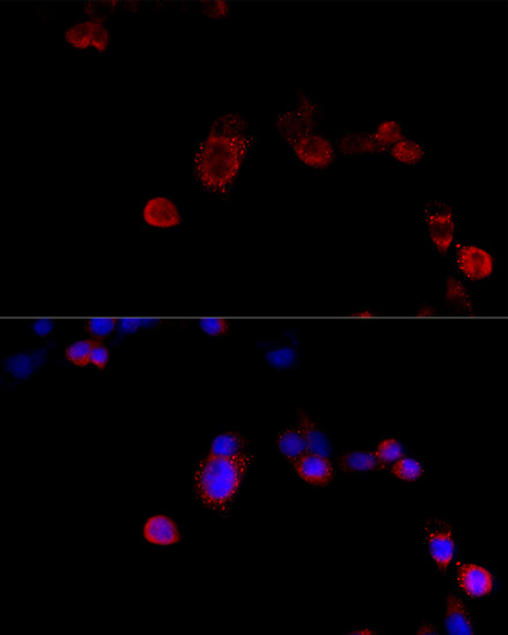 Immunofluorescence analysis of NIH/3T3 cells using FLNB Polyclonal Antibody at dilution of  1:100 (40x lens). Blue: DAPI for nuclear staining.