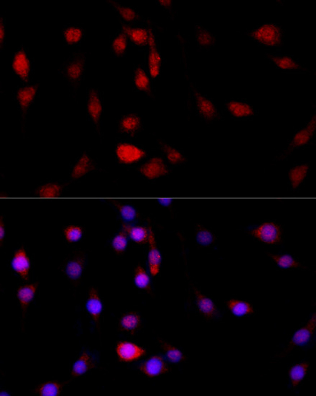 Immunofluorescence analysis of PC-12 cells using FLNB Polyclonal Antibody at dilution of  1:100 (40x lens). Blue: DAPI for nuclear staining.