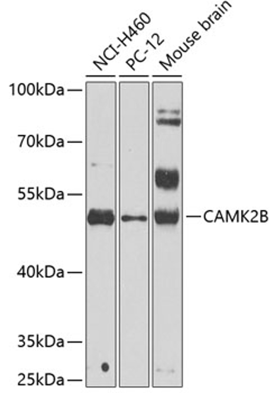 Western blot analysis of extracts of various cell lines using CAMK2B Polyclonal Antibody at dilution of 1:1000.