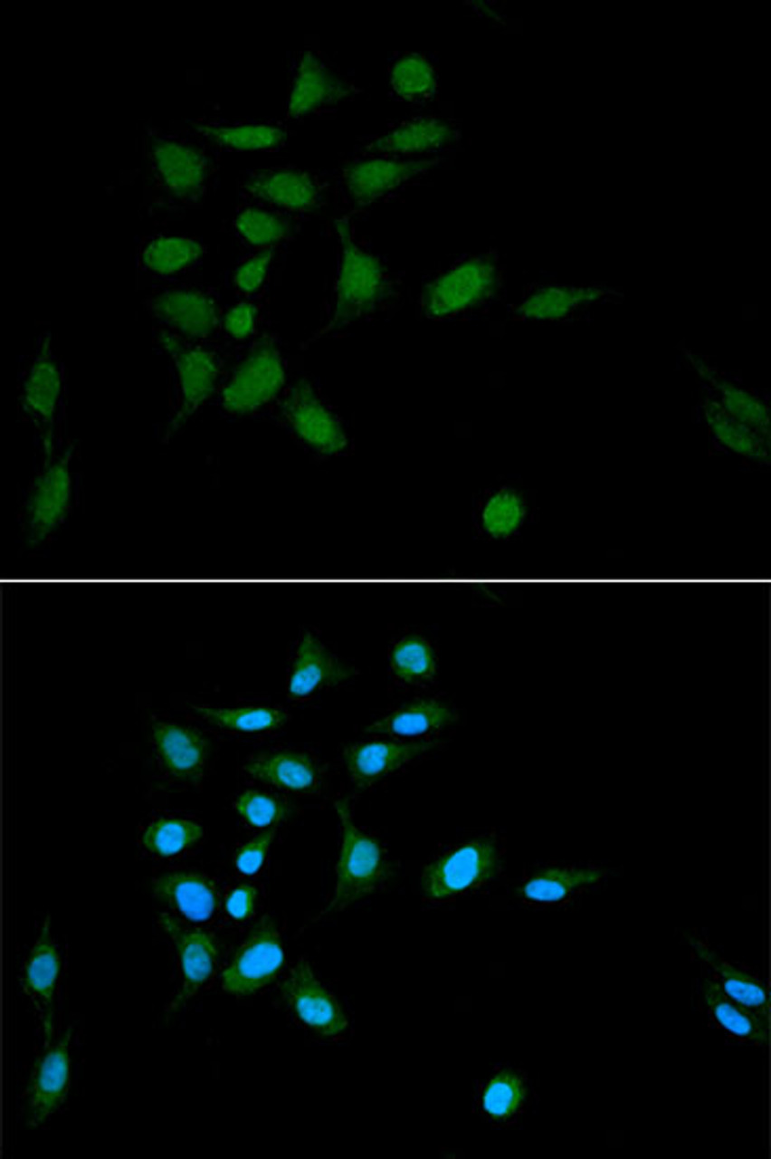 Immunofluorescence analysis of U2OS cells using PSMA1 Polyclonal Antibody at dilution of  1:100. Blue: DAPI for nuclear staining.