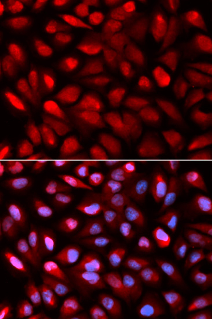 Immunofluorescence analysis of U2OS cells using PCBP2 Polyclonal Antibody