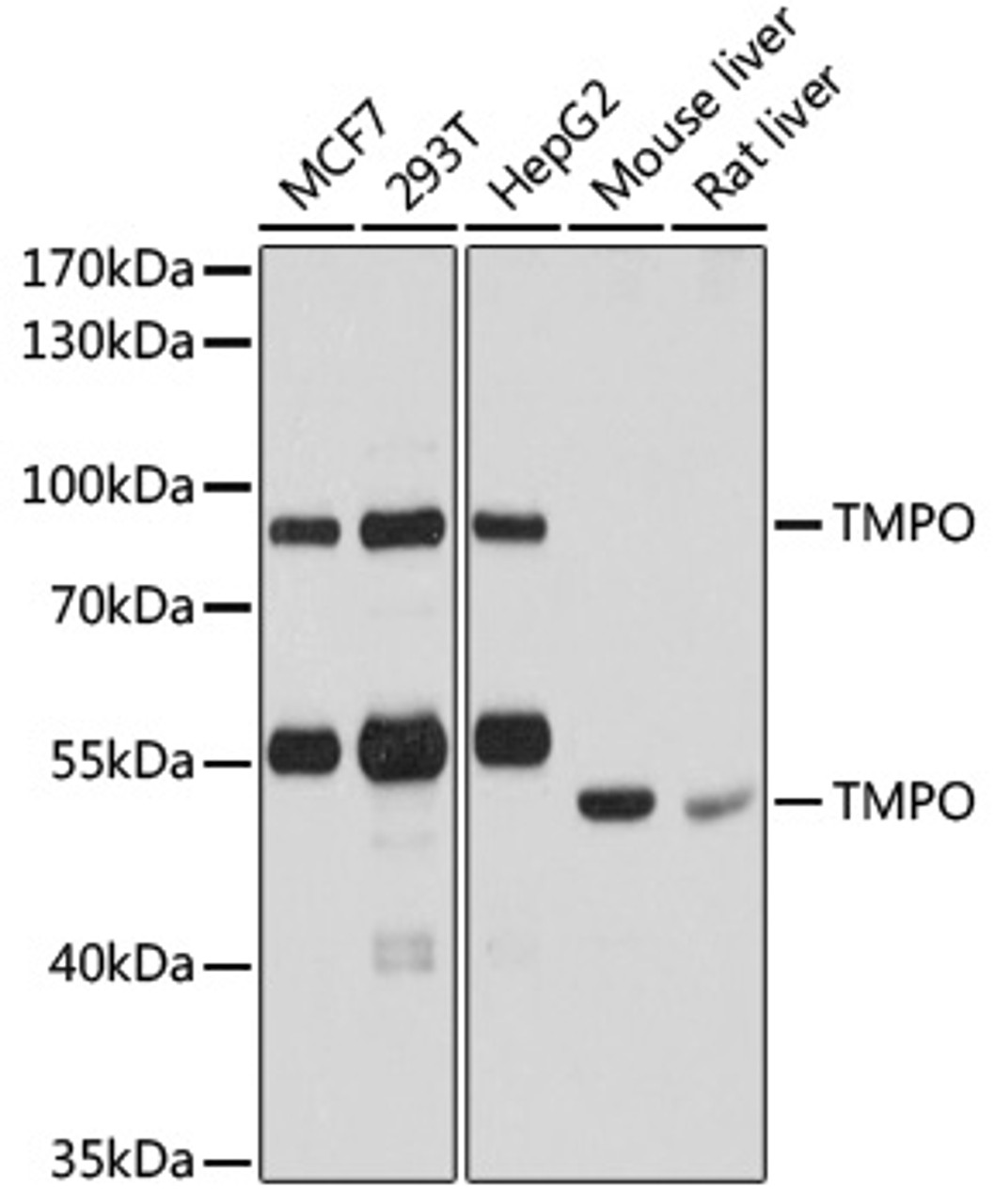 Western blot analysis of extracts of various cell lines using TMPO Polyclonal Antibody at dilution of 1:1000.