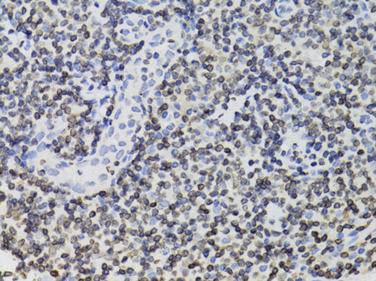 Immunohistochemistry of paraffin-embedded Human tonsil using TMPO Polyclonal Antibody at dilution of  1:100 (40x lens).