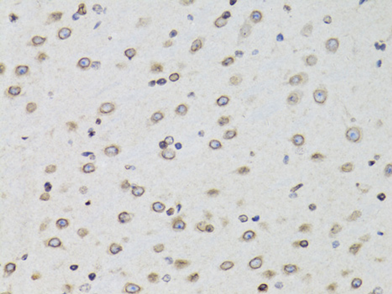 Immunohistochemistry of paraffin-embedded Mouse brain using TMPO Polyclonal Antibody at dilution of  1:100 (40x lens).