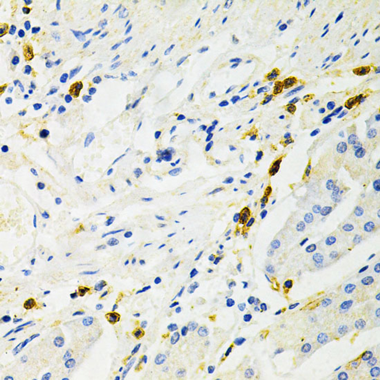 Immunohistochemistry of paraffin-embedded Human stomach using NF-kB p65 Polyclonal Antibody at dilution of  1:200 (40x lens).