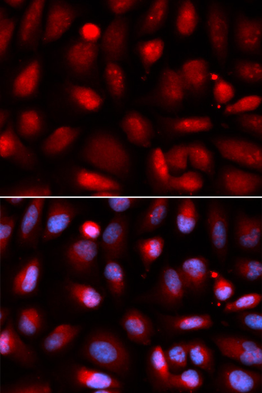 Immunofluorescence analysis of U2OS cells using NF-kB p65 Polyclonal Antibody