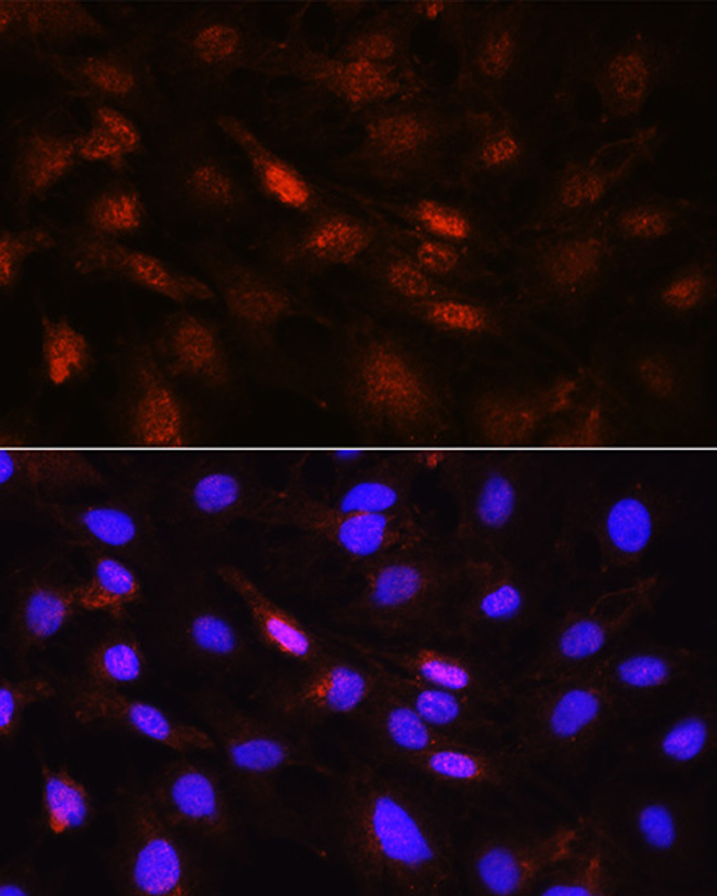 Immunofluorescence analysis of C6 cells using PLK1 Polyclonal Antibody at dilution of  1:100 (40x lens). Blue: DAPI for nuclear staining.