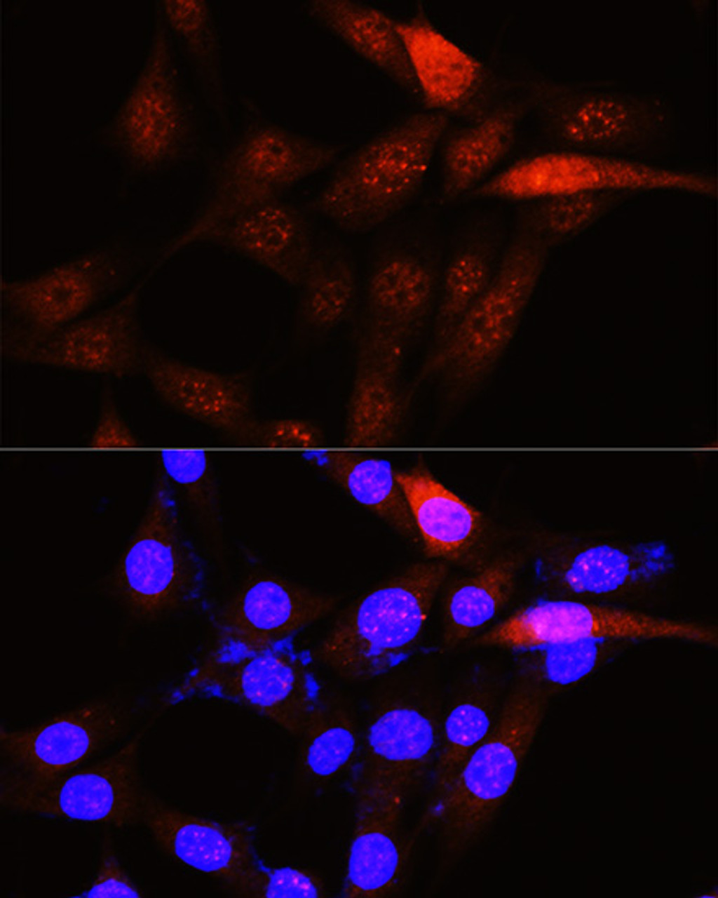 Immunofluorescence analysis of NIH-3T3 cells using PLK1 Polyclonal Antibody at dilution of  1:100 (40x lens). Blue: DAPI for nuclear staining.