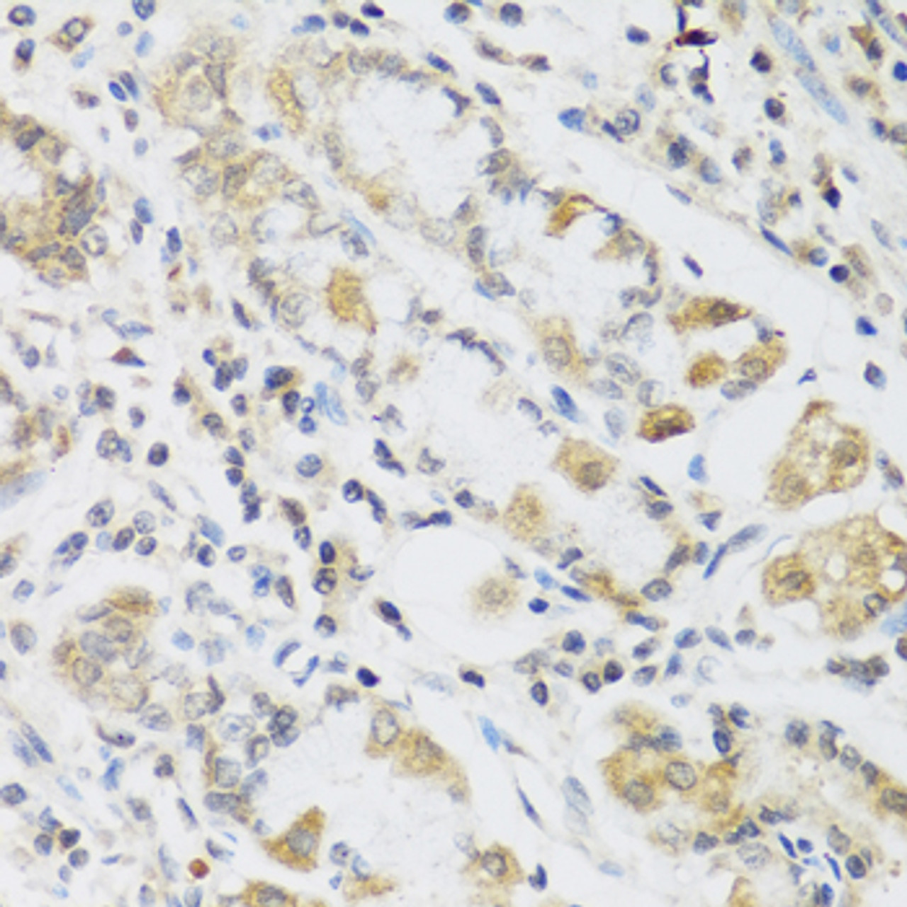 Immunohistochemistry of paraffin-embedded Human stomach using RETN Polyclonal Antibody at dilution of  1:100 (40x lens).