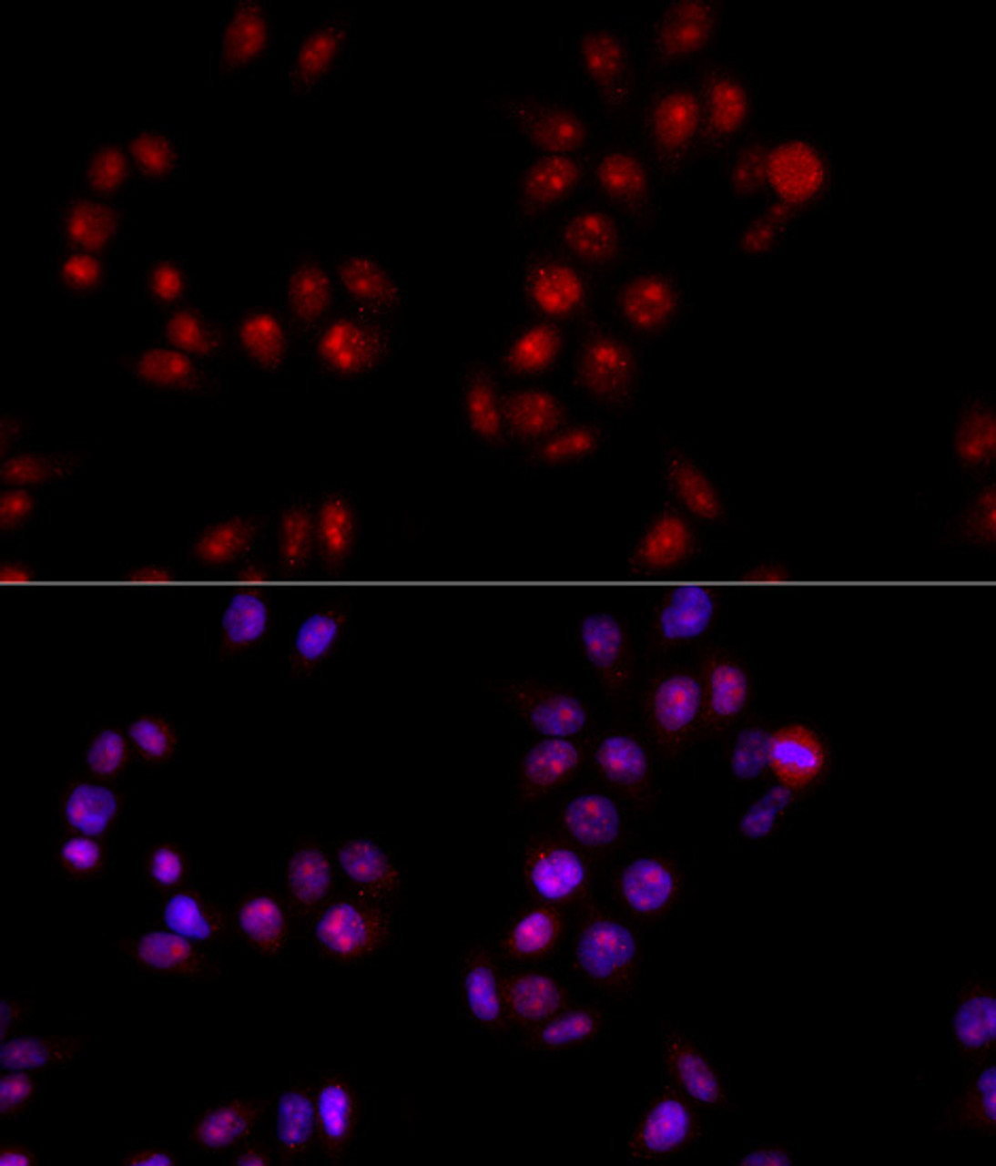 Immunofluorescence analysis of HeLa cells using HMGB1 Polyclonal Antibody at dilution of  1:100 (40x lens). Blue: DAPI for nuclear staining.