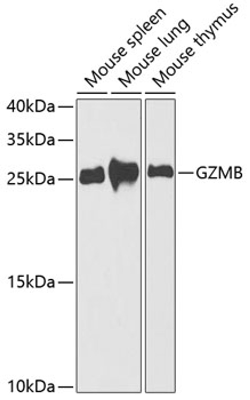 Western blot analysis of extracts of various cell lines using GZMB Polyclonal Antibody at dilution of 1:1000.
