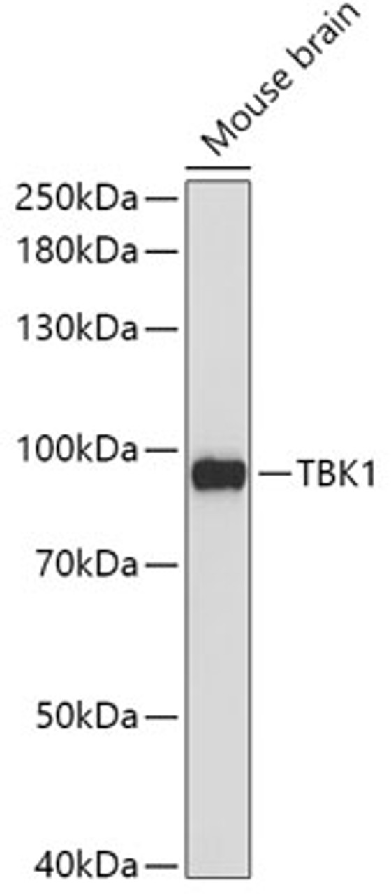Western blot analysis of extracts of Mouse brain using TBK1 Polyclonal Antibody at dilution of 1:1000.