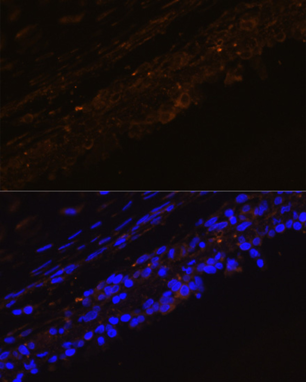 Immunofluorescence analysis of Rat bronchus cells using KRT7 Polyclonal Antibody at dilution of  1:100. Blue: DAPI for nuclear staining.