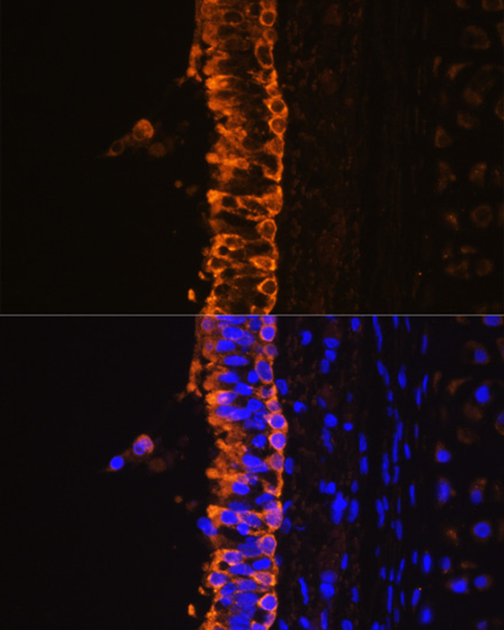 Immunofluorescence analysis of Rat bronchus cells using KRT7 Polyclonal Antibody at dilution of  1:100. Blue: DAPI for nuclear staining.