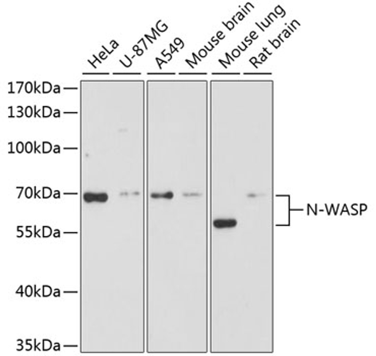 Western blot analysis of extracts of various cell lines using N-WASP Polyclonal Antibody at dilution of 1:3000.