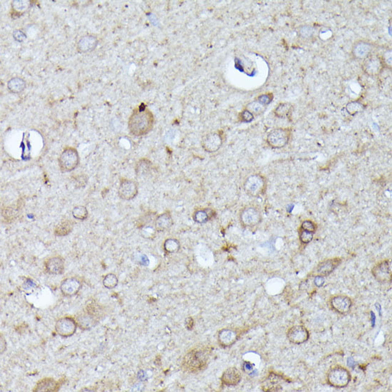 Immunohistochemistry of paraffin-embedded Rat brain using N-WASP Polyclonal Antibody at dilution of  1:100 (40x lens).