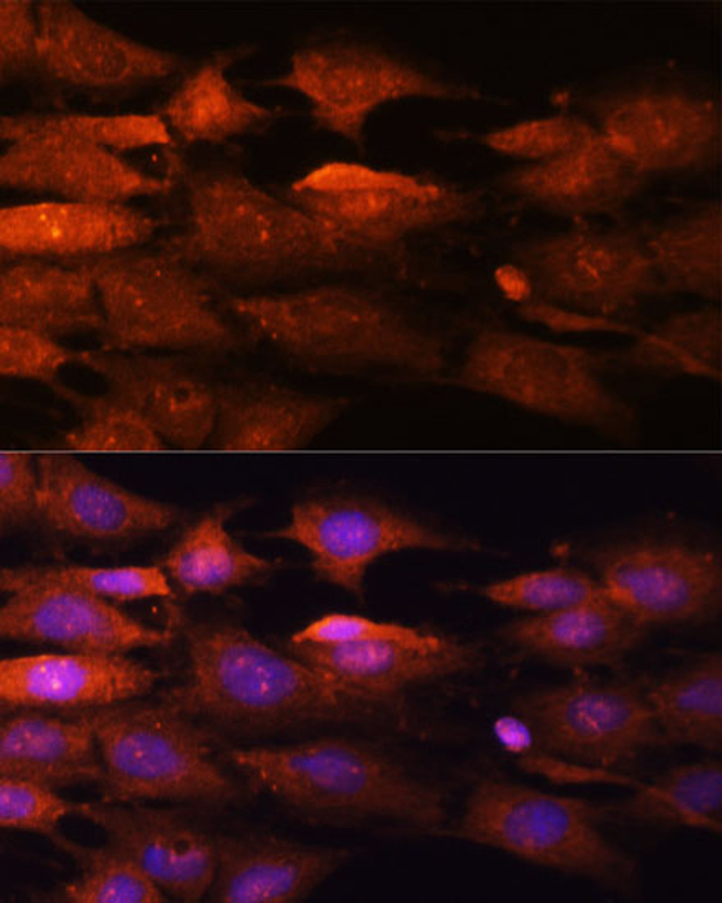 Immunofluorescence analysis of C6 cells using N-WASP Polyclonal Antibody at dilution of  1:100 (40x lens). Blue: DAPI for nuclear staining.