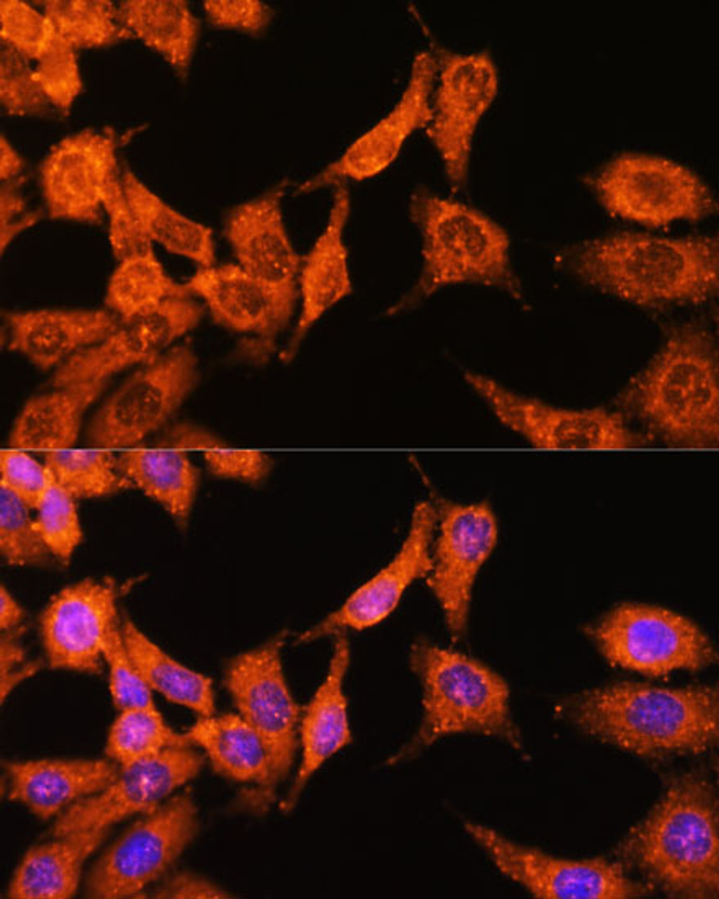 Immunofluorescence analysis of HeLa cells using N-WASP Polyclonal Antibody at dilution of  1:100 (40x lens). Blue: DAPI for nuclear staining.