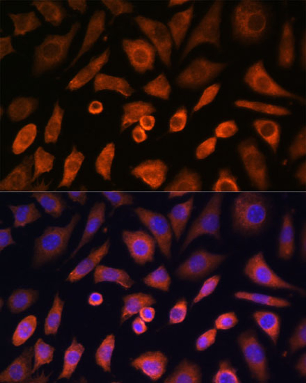 Immunofluorescence analysis of L-929 cells using N-WASP Polyclonal Antibody at dilution of  1:100 (40x lens). Blue: DAPI for nuclear staining.
