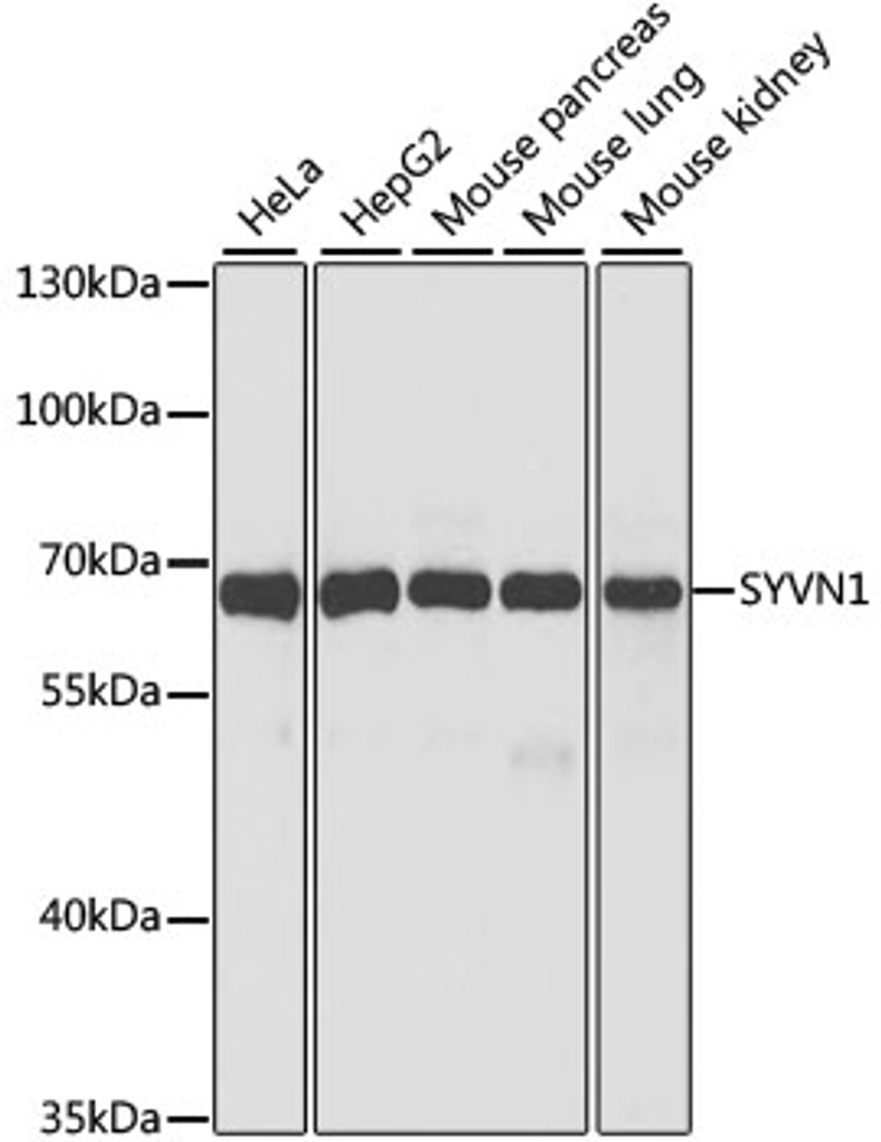 Western blot analysis of extracts of various cell lines using SYVN1 Polyclonal Antibody at dilution of 1:1000.
