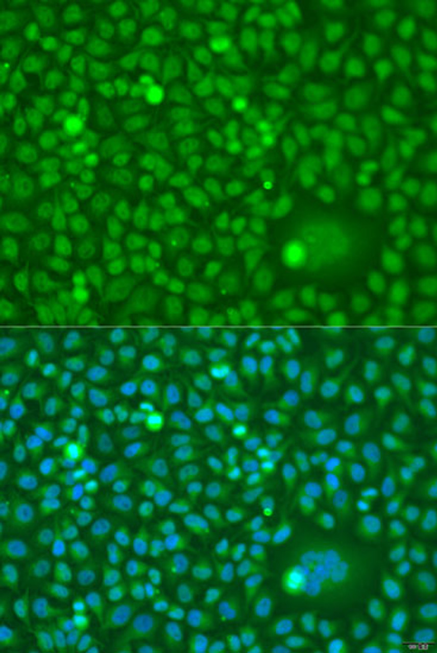 Immunofluorescence analysis of U2OS cells using CDK10 Polyclonal Antibody at dilution of  1:100. Blue: DAPI for nuclear staining.