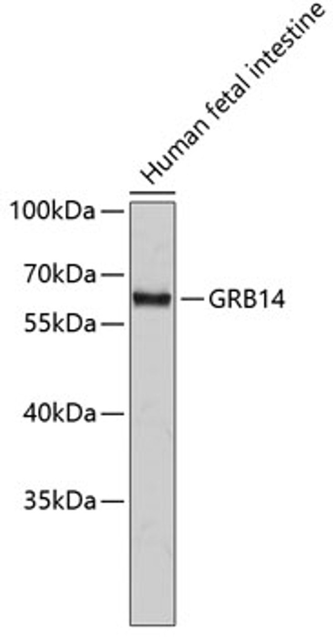 Western blot analysis of extracts of Human fetal intestine using GRB14 Polyclonal Antibody.