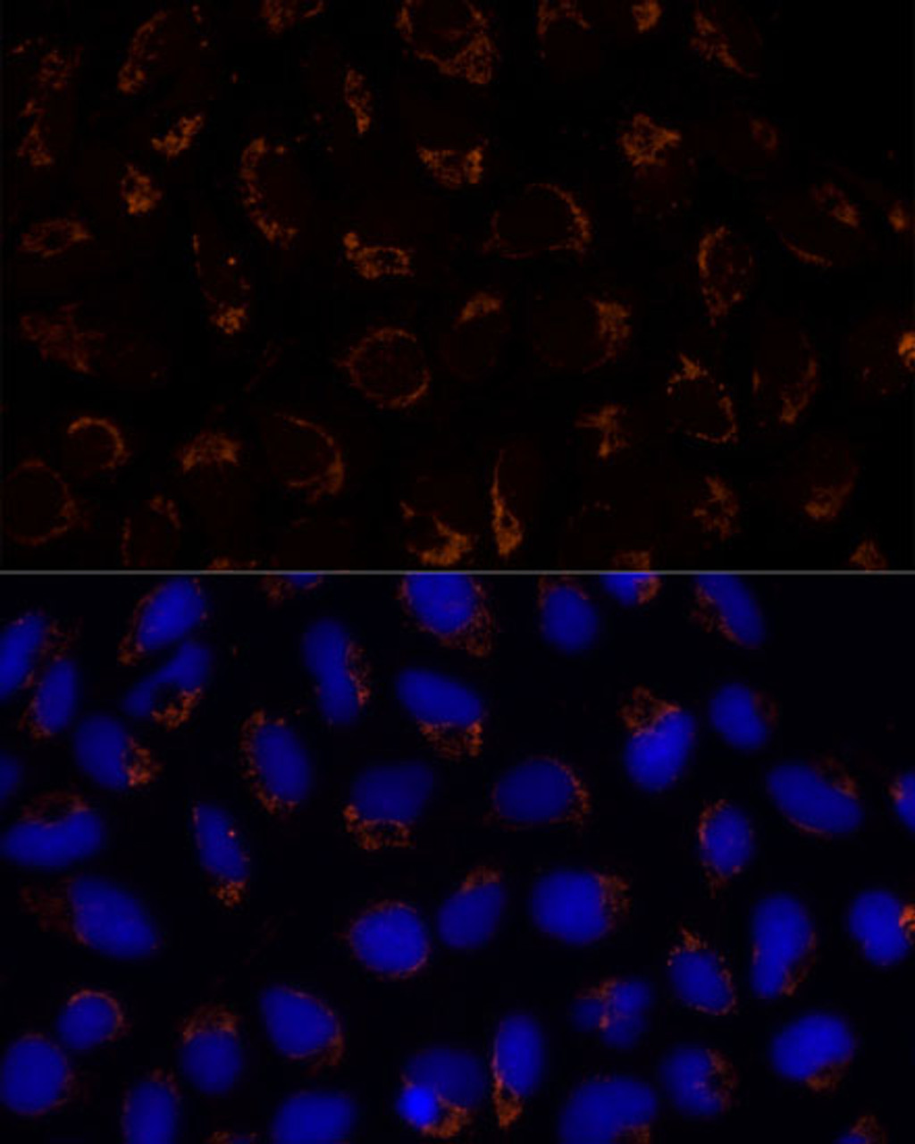 Immunofluorescence analysis of U-2 OS cells using TRAP1 Polyclonal Antibody at dilution of  1:100 (40x lens). Blue: DAPI for nuclear staining.