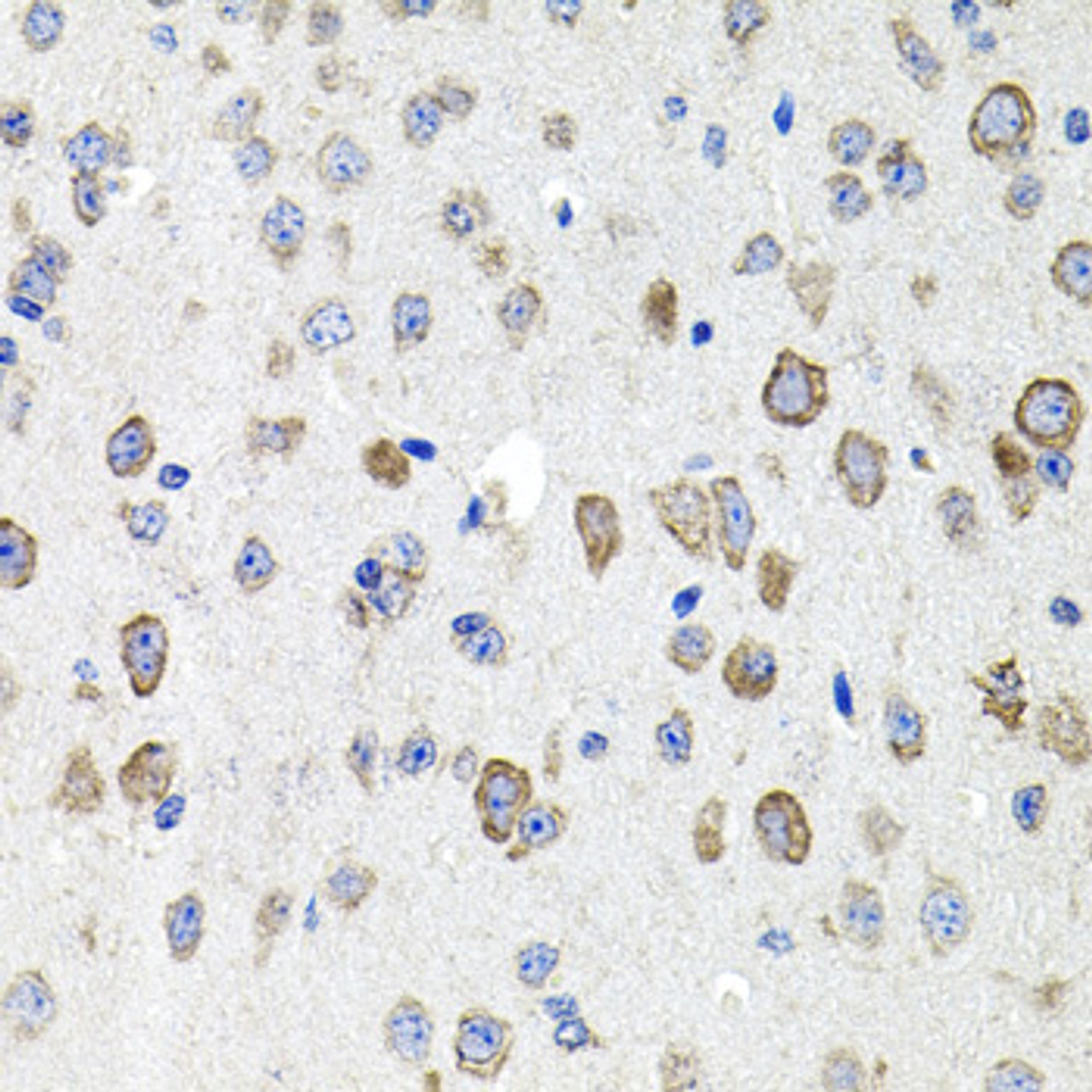Immunohistochemistry of paraffin-embedded Mouse brain using CDH23 Polyclonal Antibody at dilution of  1:100 (40x lens).