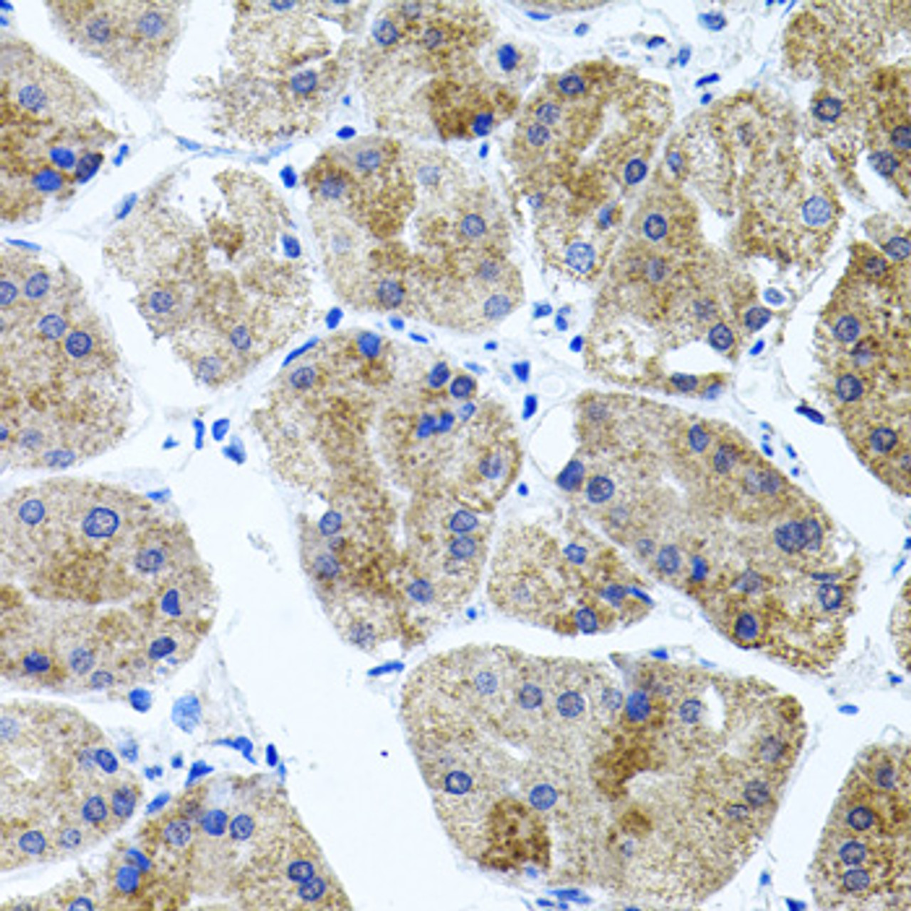 Immunohistochemistry of paraffin-embedded Human stomach using CDH23 Polyclonal Antibody at dilution of  1:100 (40x lens).